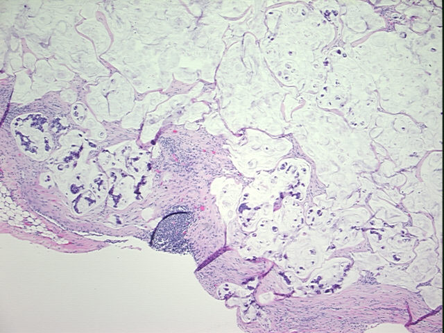 4x Image