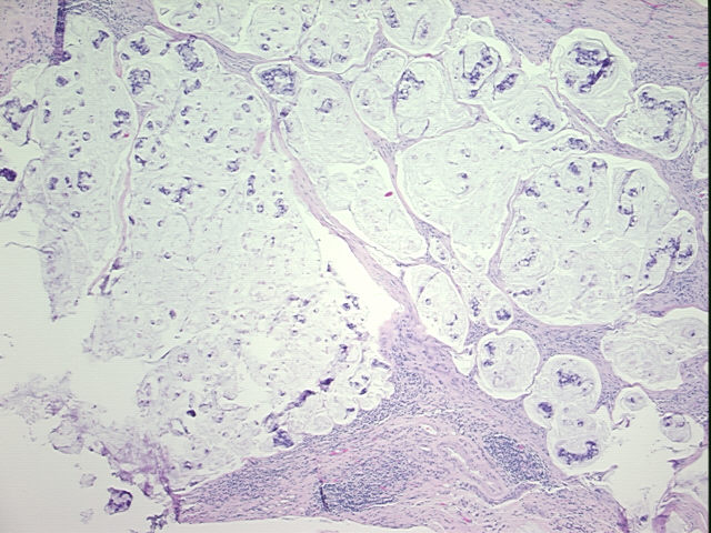 4x Image