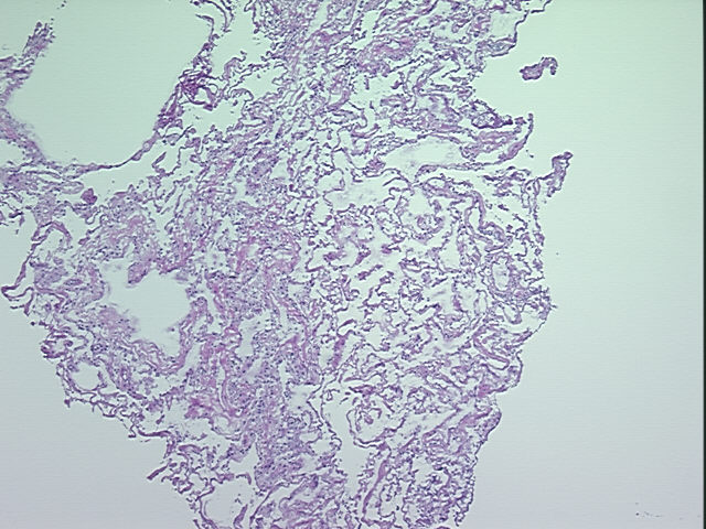4x Image