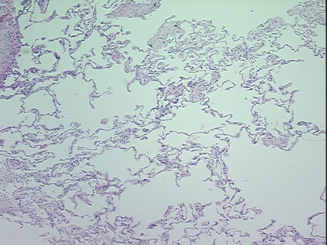 4x Image