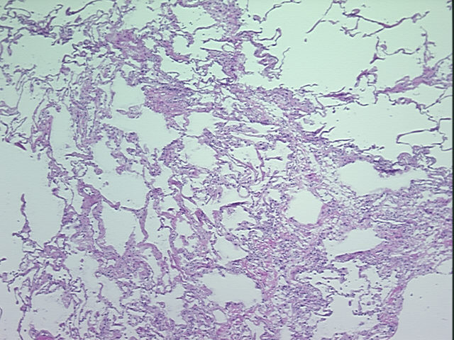 4x Image