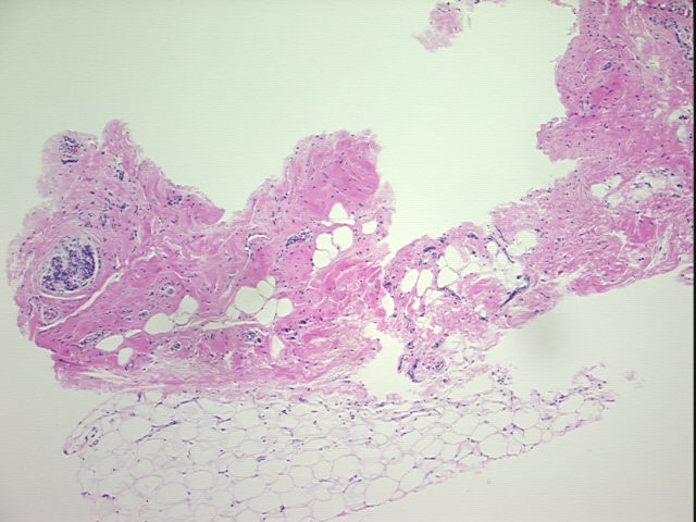 4x Image