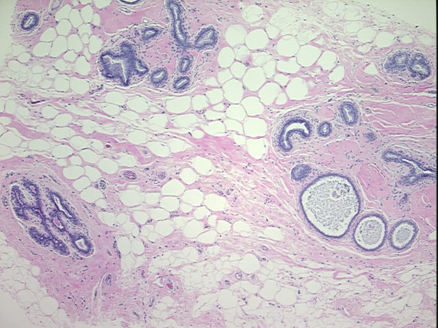 4x Image