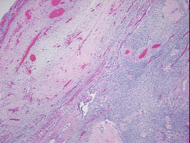 4x Image