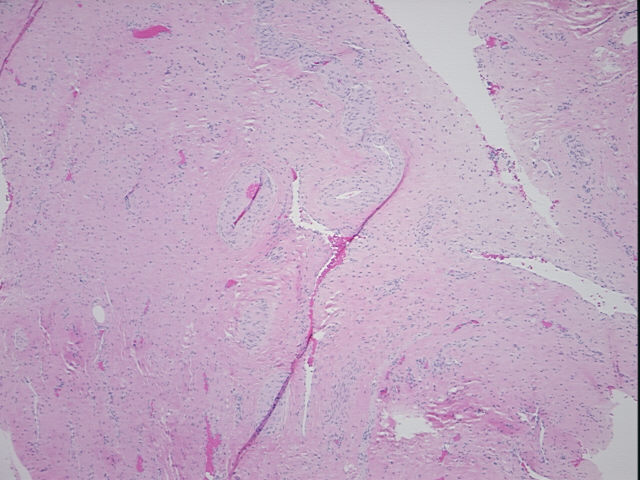 4x Image