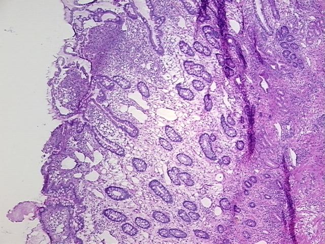4x Image