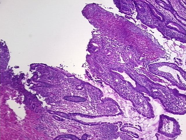 4x Image