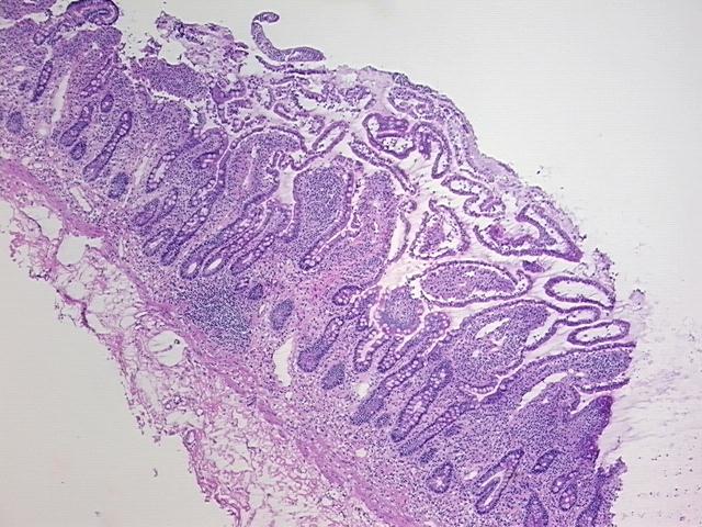 4x Image