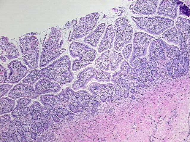 4x Image