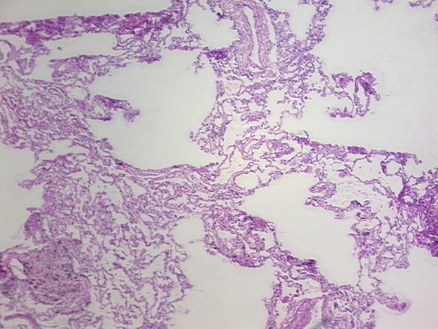 4x Image
