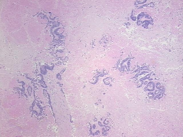 4x Image