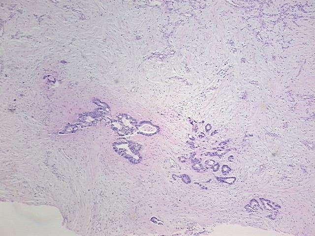 4x Image