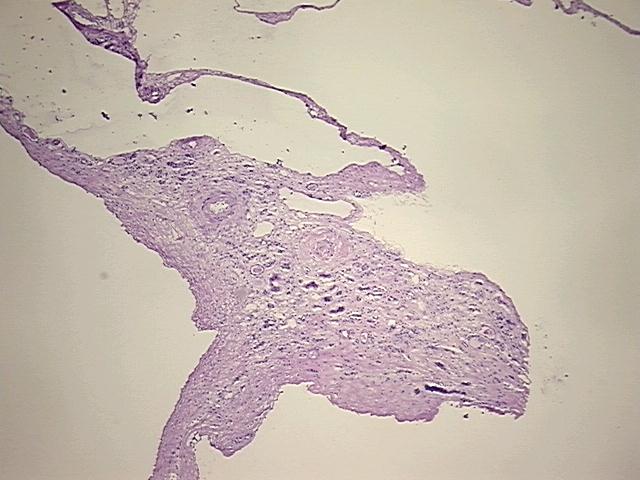 Frozen Tissue Sections, Kidney | CS619367 | OriGene Technologies Inc.
