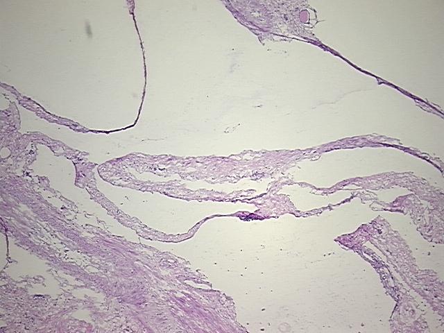 4x Image