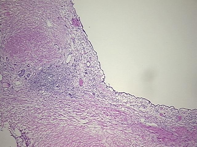 4x Image