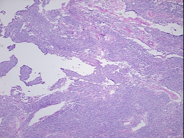 4x Image