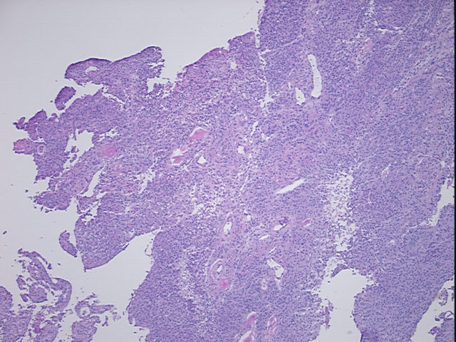 4x Image