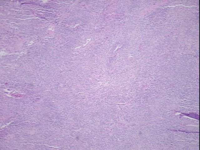 4x Image