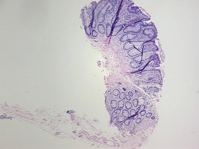 4x Image