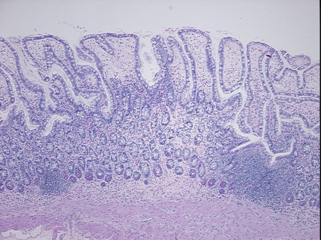 4x Image