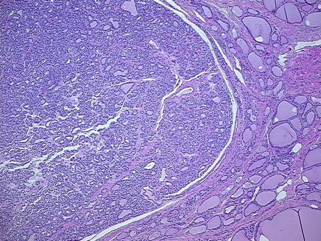 4x Image
