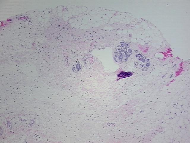 4x Image
