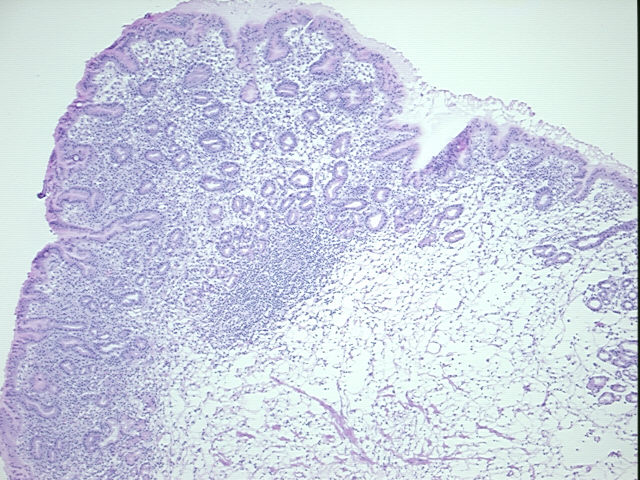 4x Image