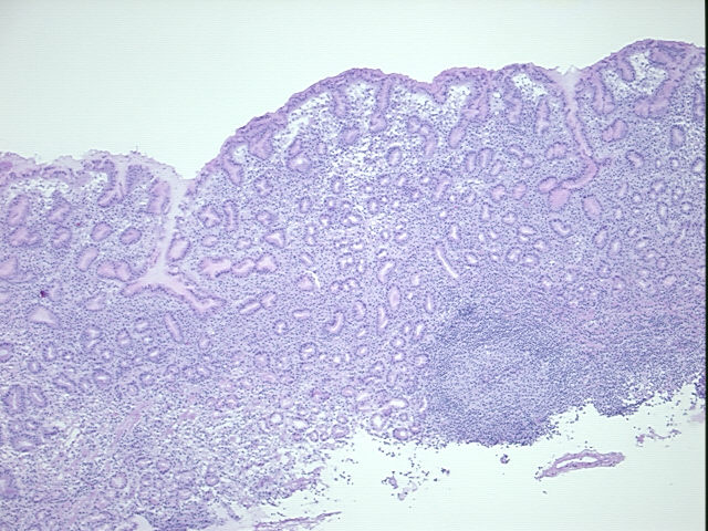 4x Image