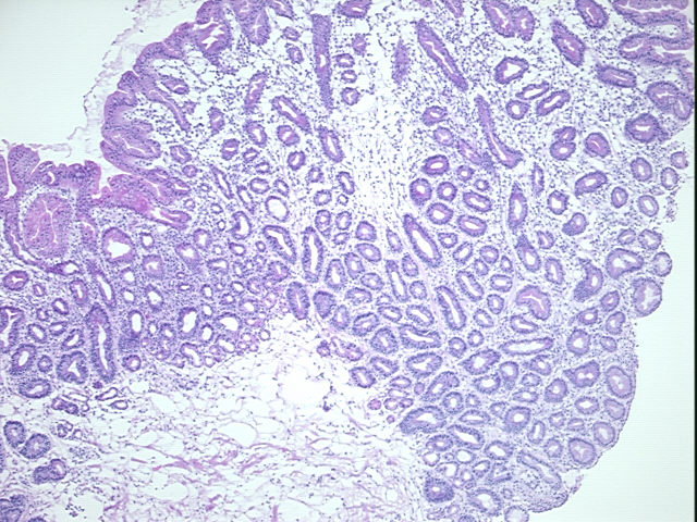 4x Image