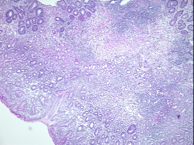 4x Image