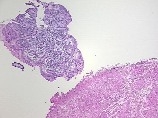 4x Image