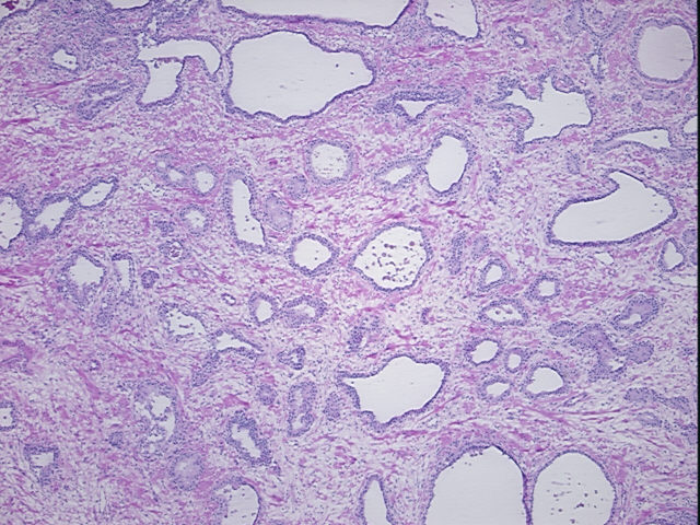 4x Image