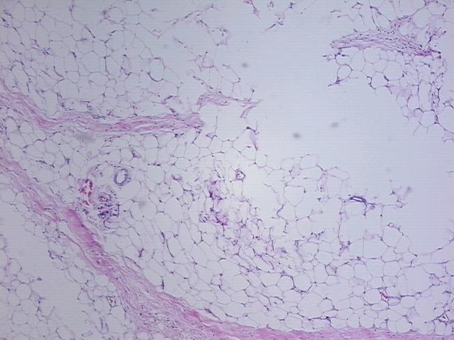 4x Image