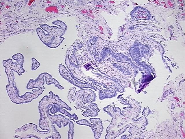 4x Image