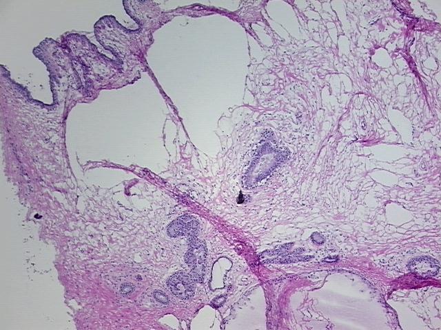 4x Image