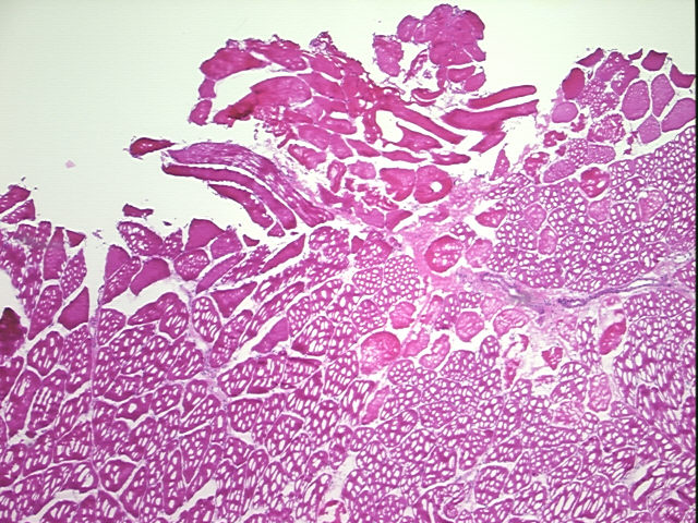 4x Image