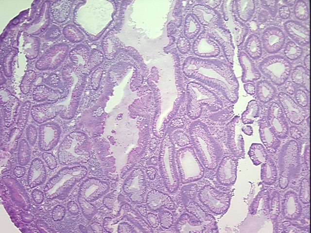 4x Image