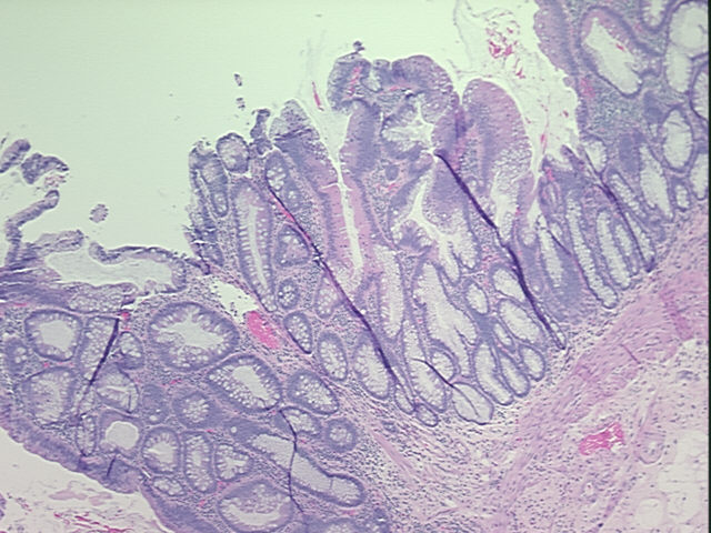 4x Image
