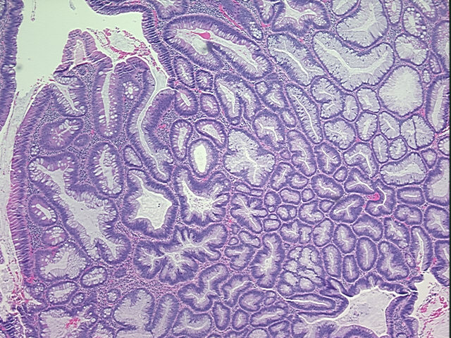 4x Image