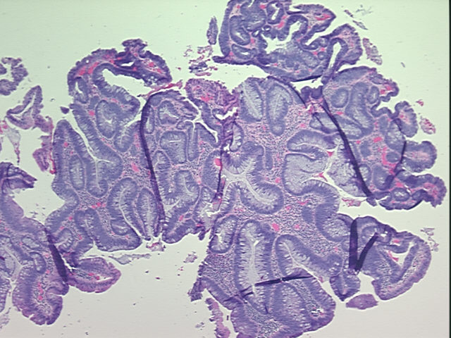 4x Image