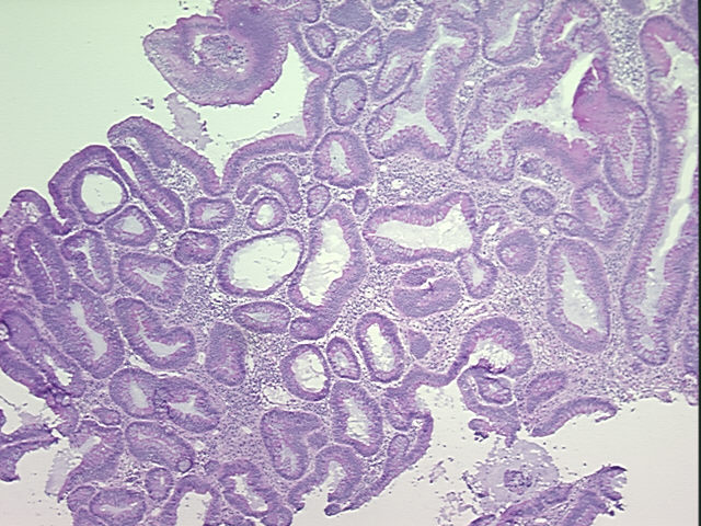 4x Image
