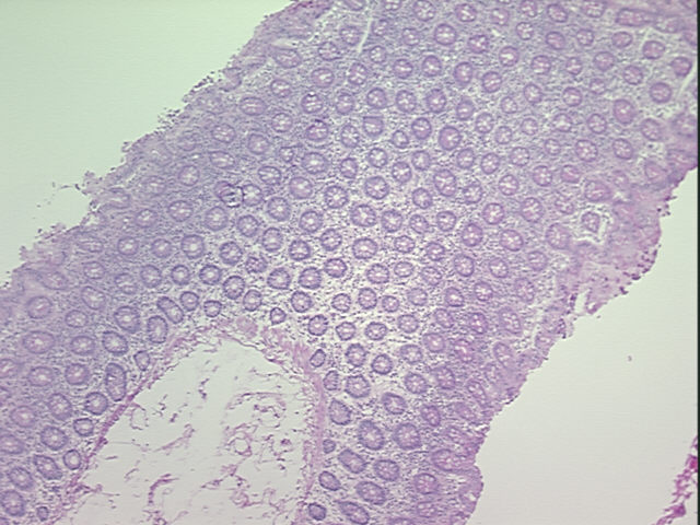 4x Image