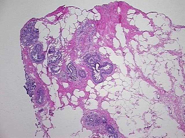 4x Image