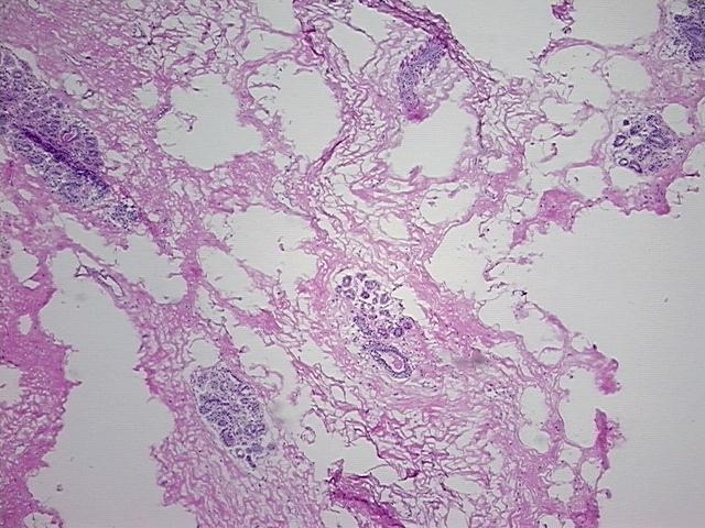 ほのページ Tissue Sections (5x5um), Frozen; Breast; Within normal