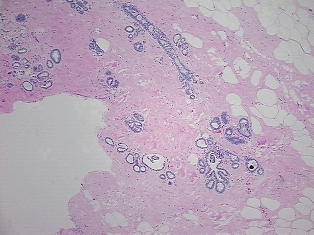 4x Image