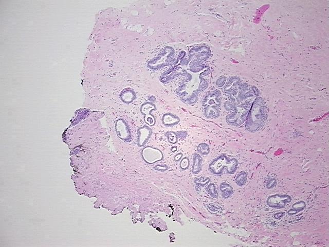 4x Image