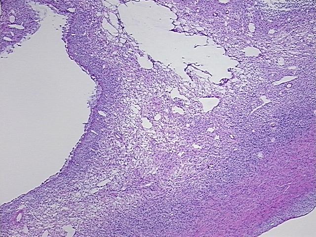 4x Image