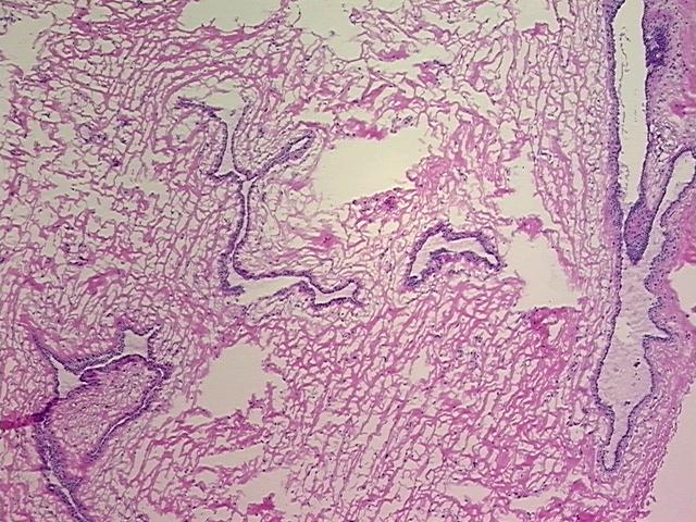 Frozen Tissue Sections, Breast