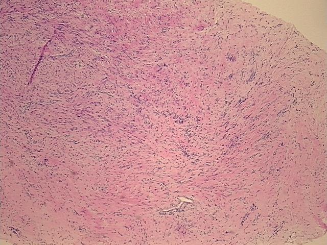 4x Image