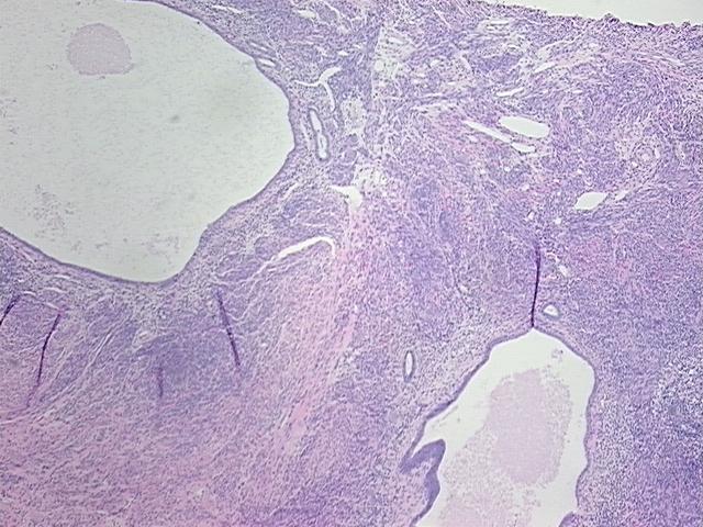 4x Image